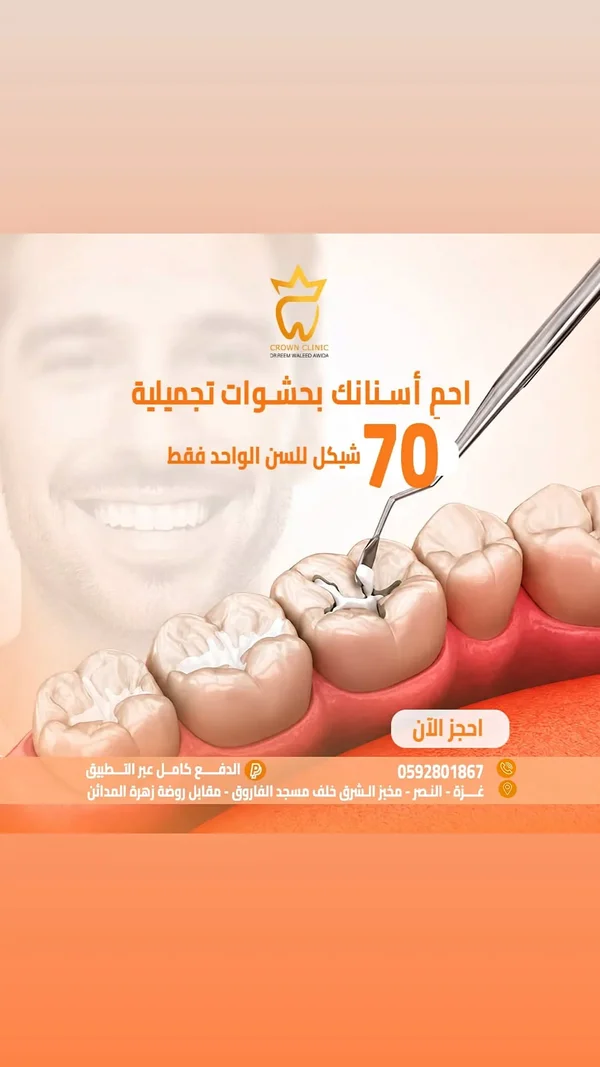 حشوات أسنان تجميلية - عيادة كراون (Crown Clinic) - خدمات صحية - سوق غزة