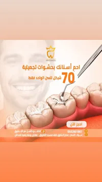 حشوات أسنان تجميلية - عيادة كراون (Crown Clinic) - سوق غزة